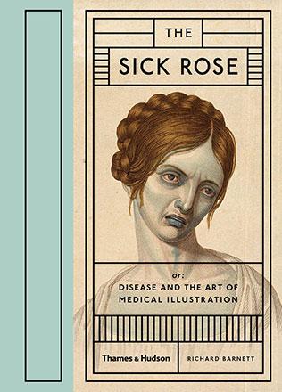 The Sick Rose: Or: Disease and the Art of Medical Illustration